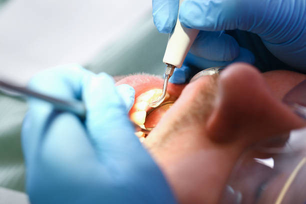 Best Emergency Dental Care for Broken or Chipped Teeth in Islip Terrace, NY